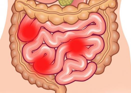 Cum se vindeca intestinul?